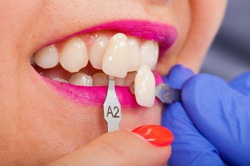 dentist eltham
